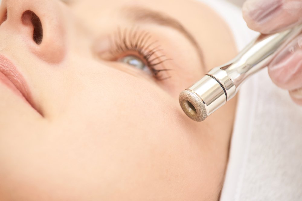 Which Is Better: Microdermabrasion or Chemical Peels?